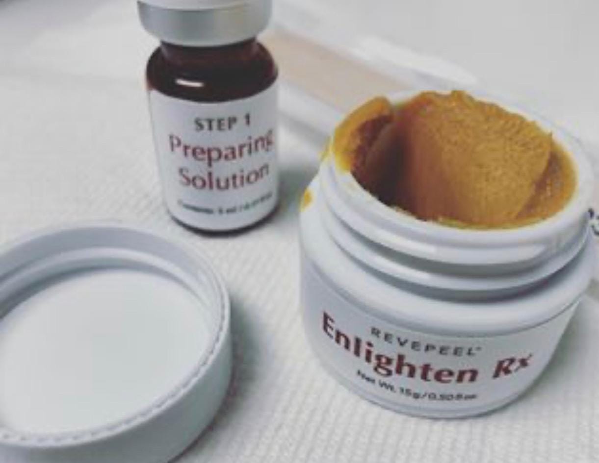 Acne and Hyperpigmentation
