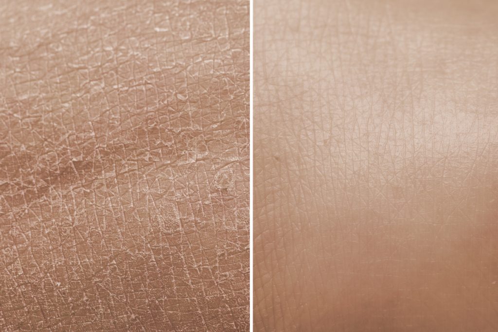 Dry to Dewy