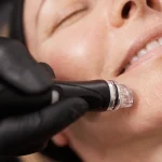 Hydrafacial treatment at Venus spa east Boston -deep cleansing and hydration