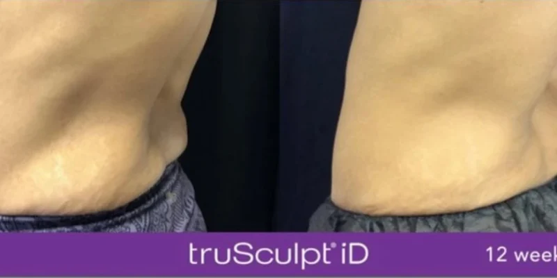 truSculptID